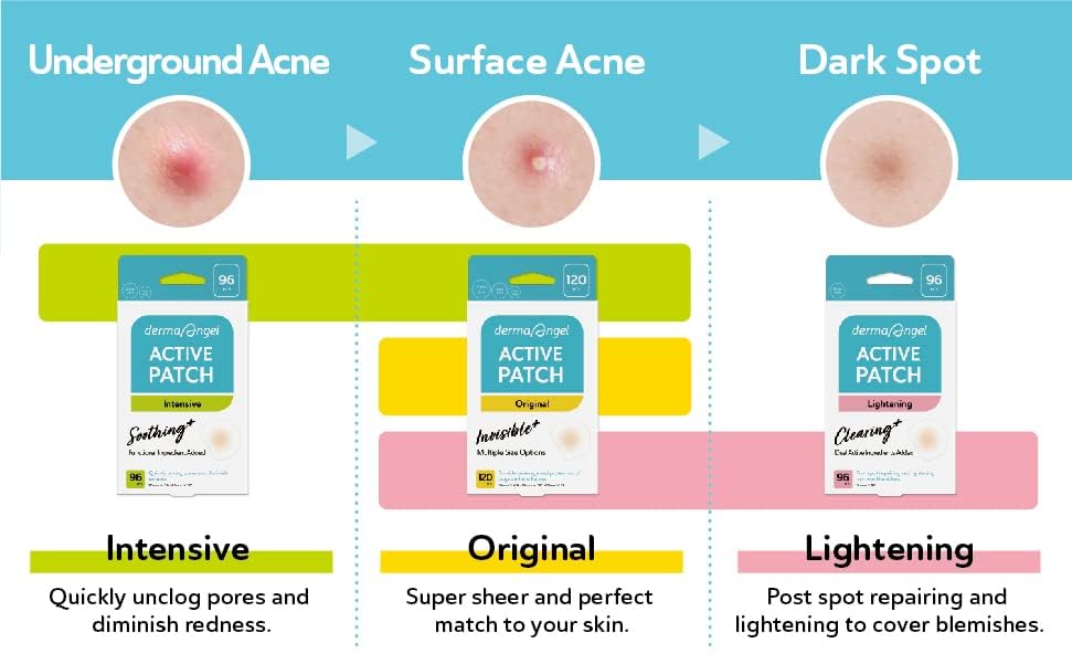DERMA ANGEL post acne patch targets mild dark spots for even tone