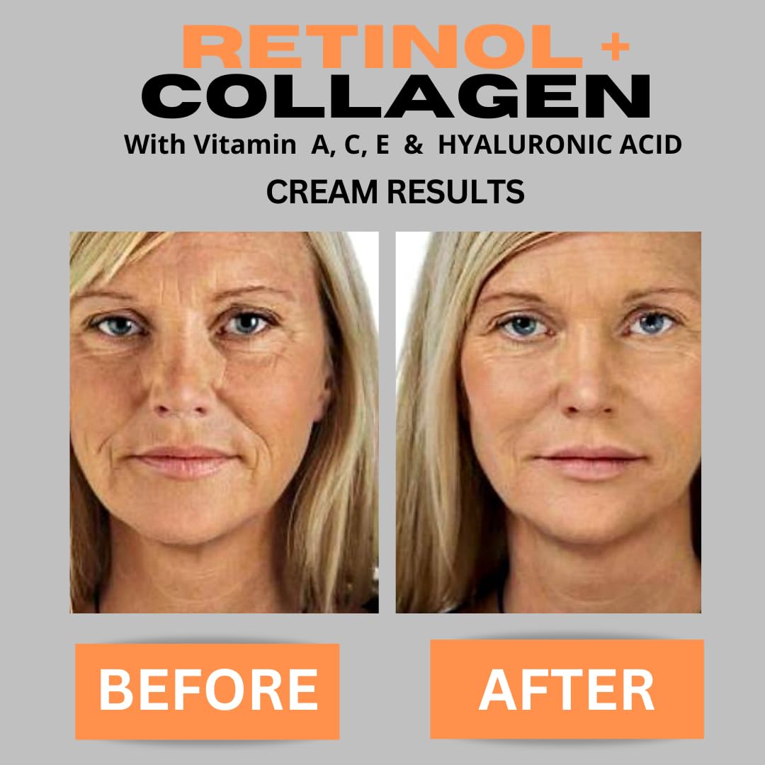DERMA CLINICALS face-cream texture-swirl shows smooth, comfortable application.