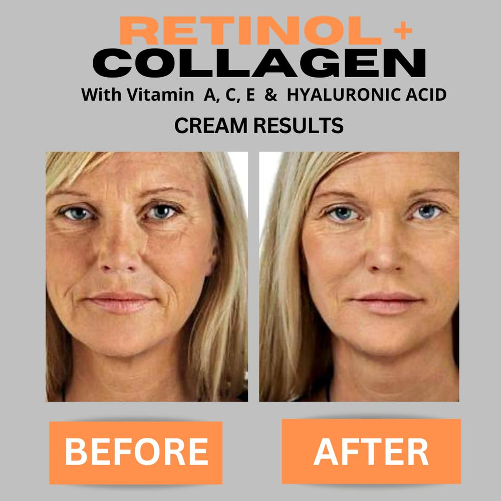 DERMA CLINICALS face-cream texture-swirl shows smooth, comfortable application.