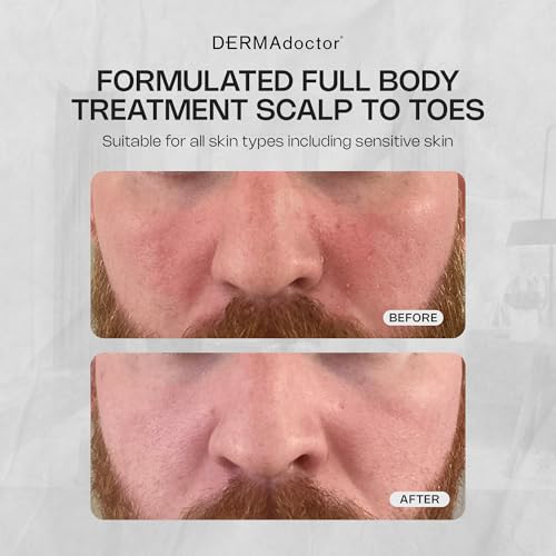DERMAdoctor face wash lather close-up, showcasing rich foam for gentle cleansing