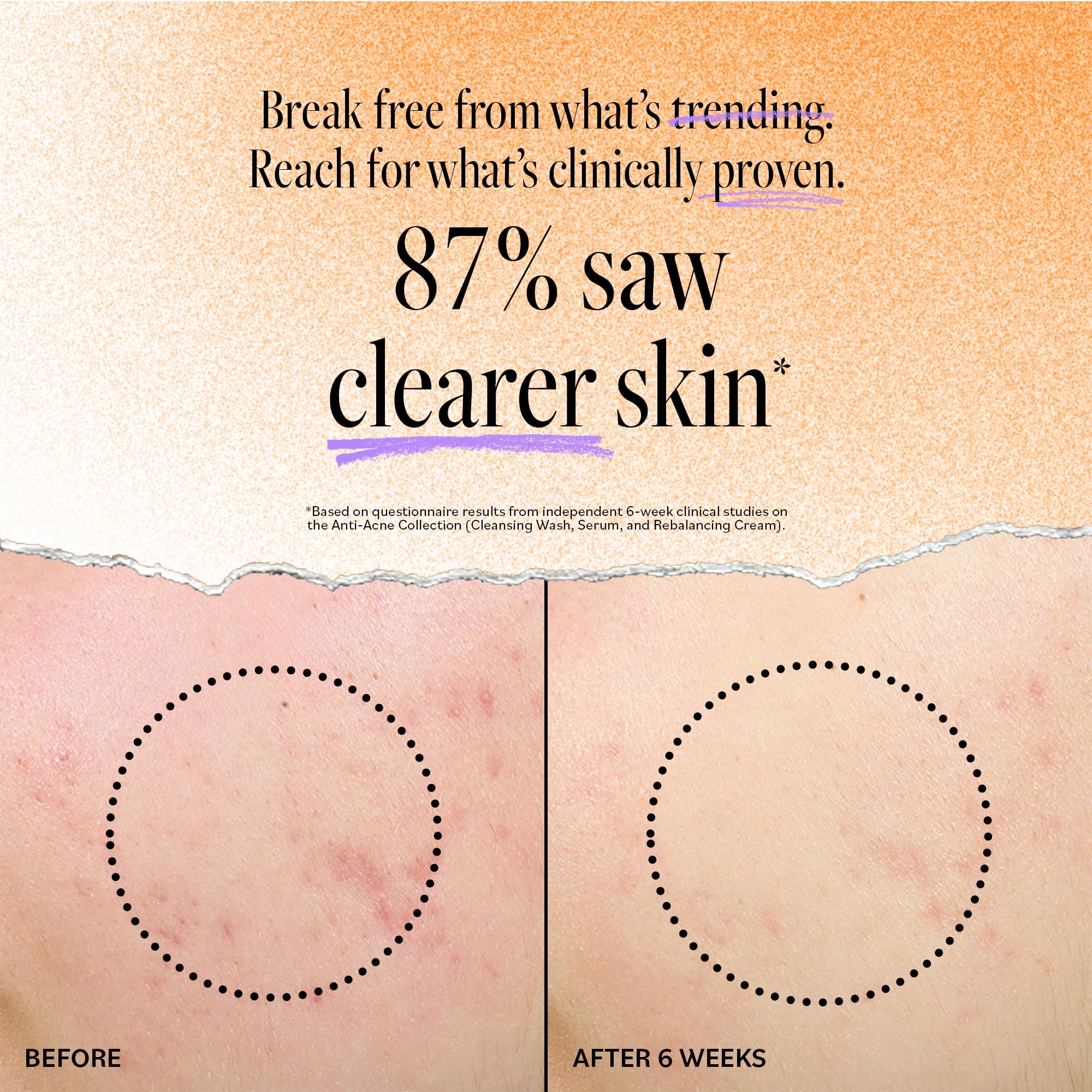 Derma E Acne Deep Pore Cleansing Wash ingredients highlight tea tree oil for soothing care.