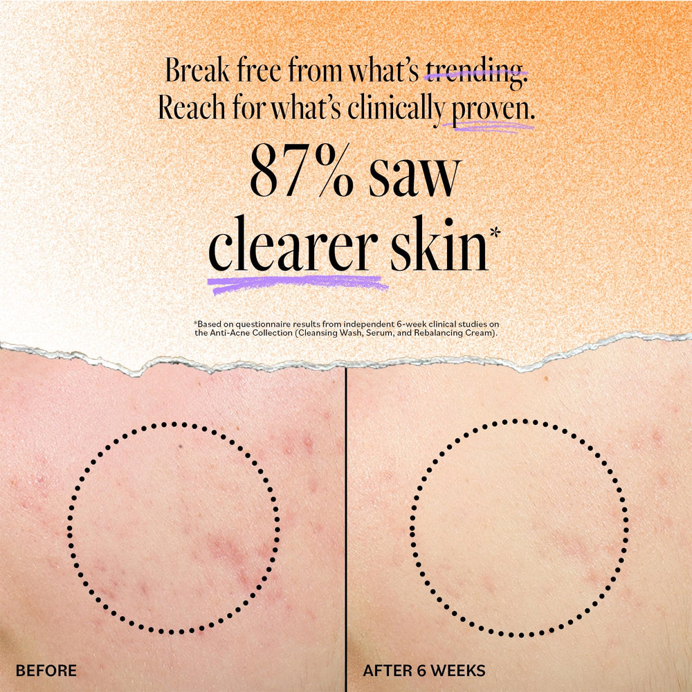 Derma E Acne Deep Pore Cleansing Wash ingredients highlight tea tree oil for soothing care.