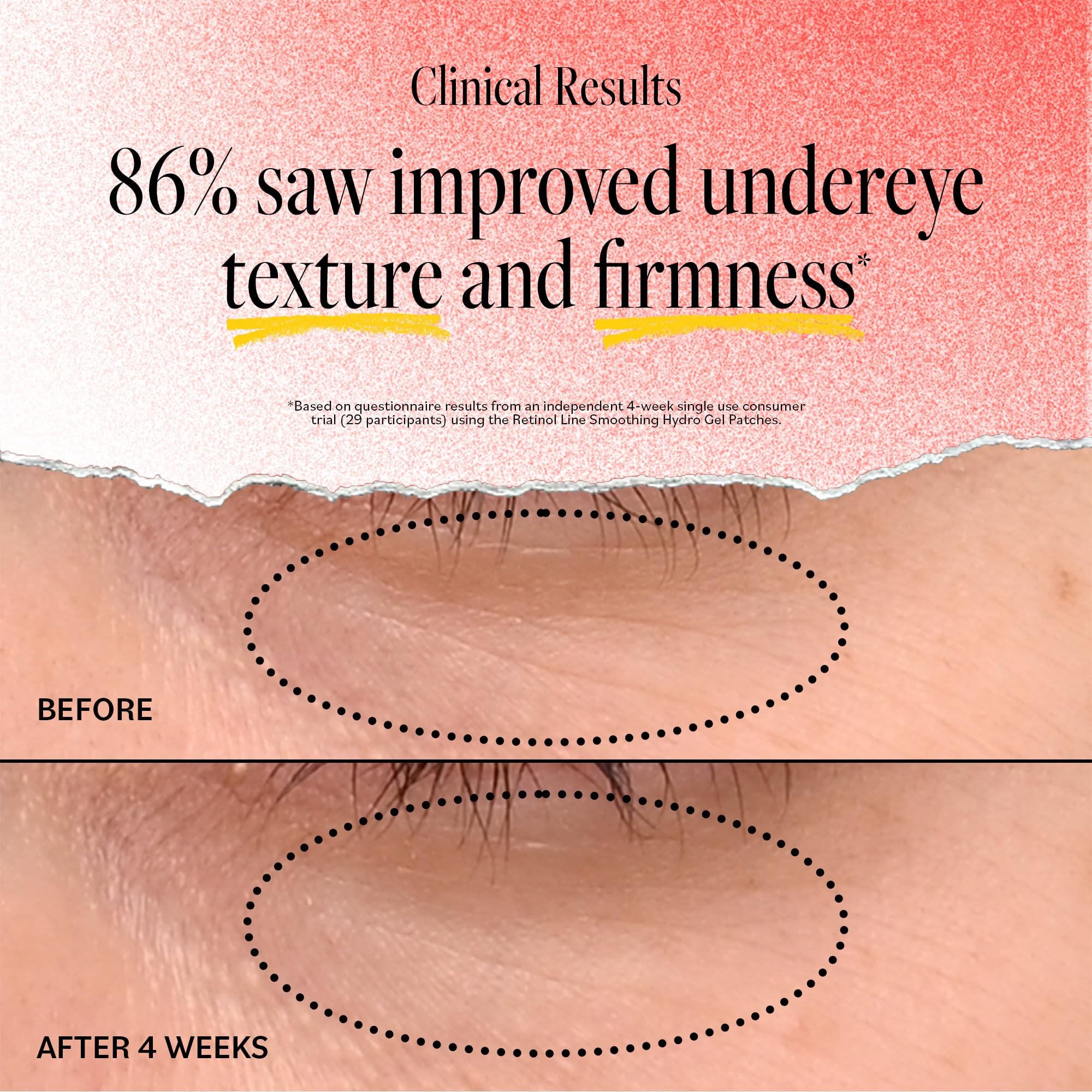 Derma E eye patches rose water hibiscus petals close-up illustrate soothing hydration
