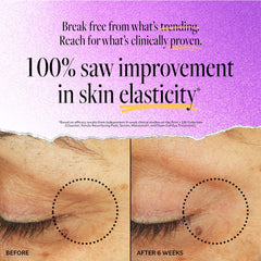 Derma E Stem Cell Lifting Eye Treatment upper eyelid application highlighting firming and elasticity.