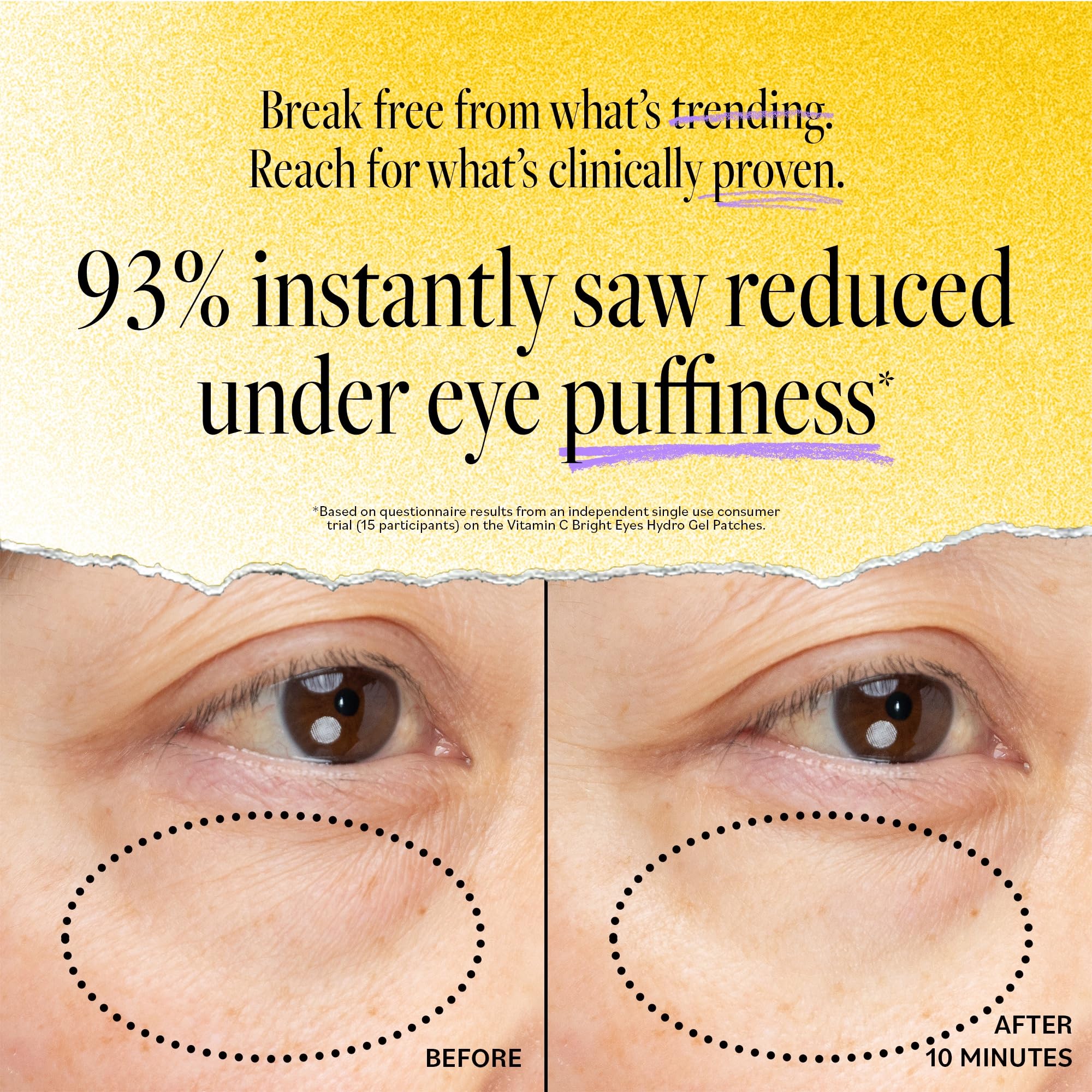 Derma E Vitamin C Bright Eyes patches texture close-up highlighting serum-infused surface.