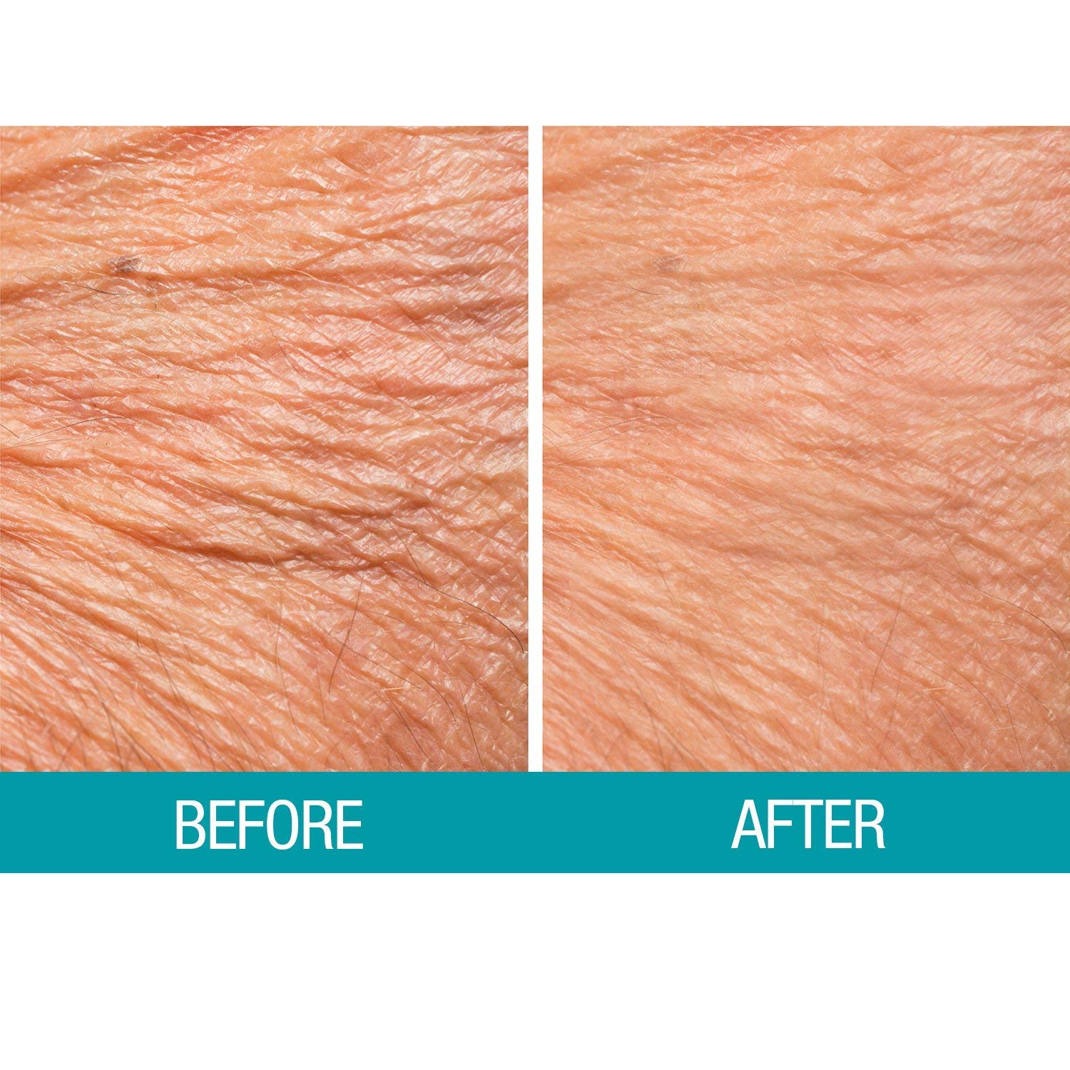 Dermactin Crepe Be Gone Body Souffle premium crepe care formula.