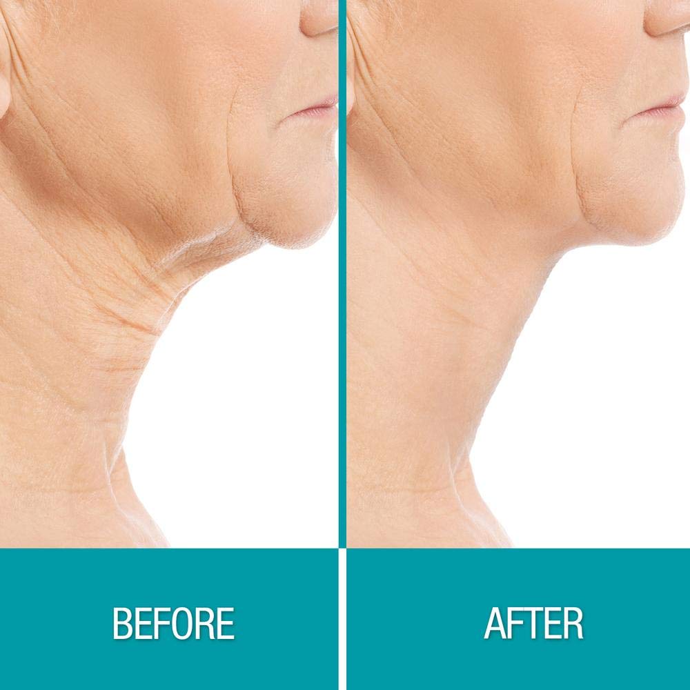 Dermactin Crepe Be Gone plant extracts blend supports skin-restoration-inspired feel.