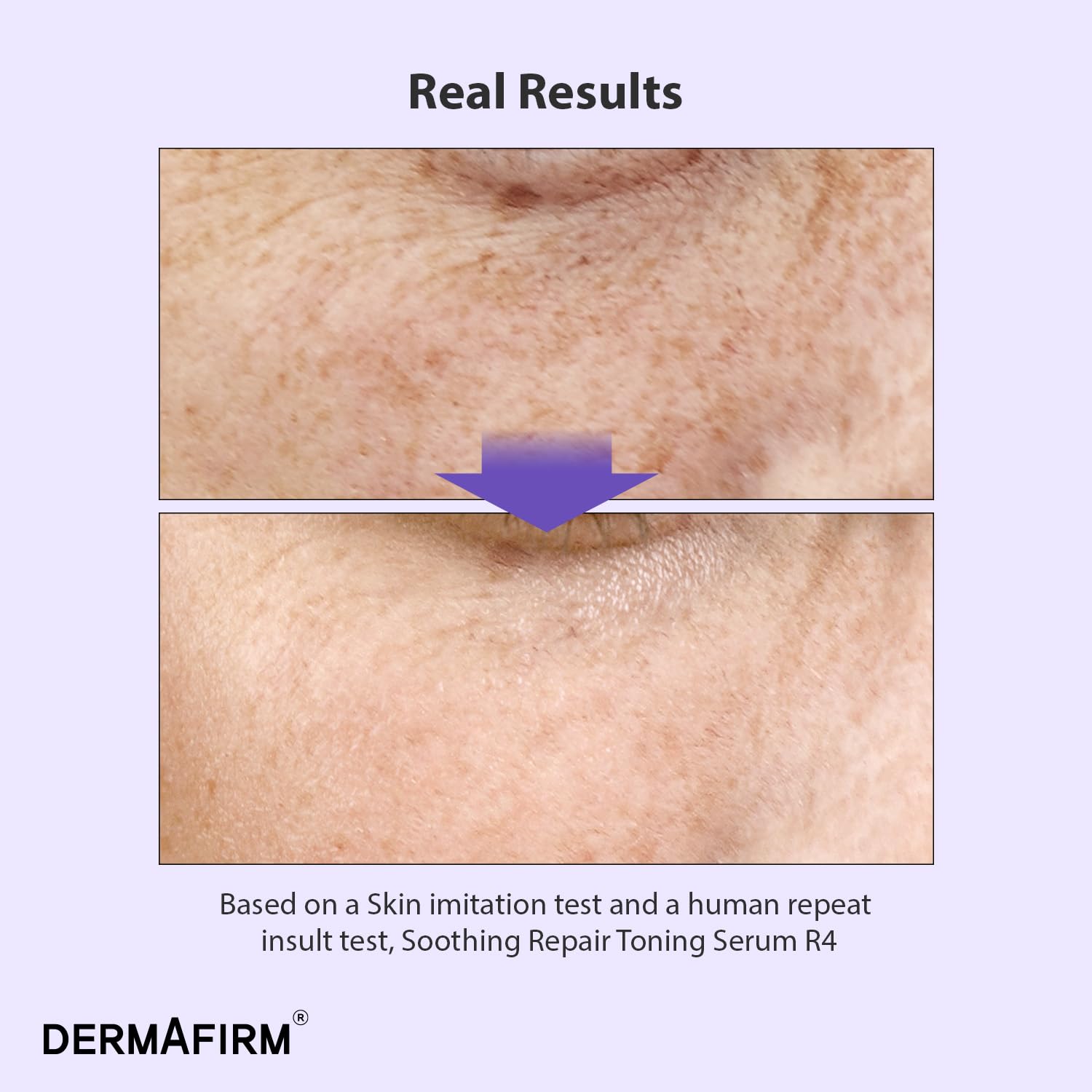 Dermafirm perilla leaf extract visual—soothing plant-based care for irritated or uneven skin.