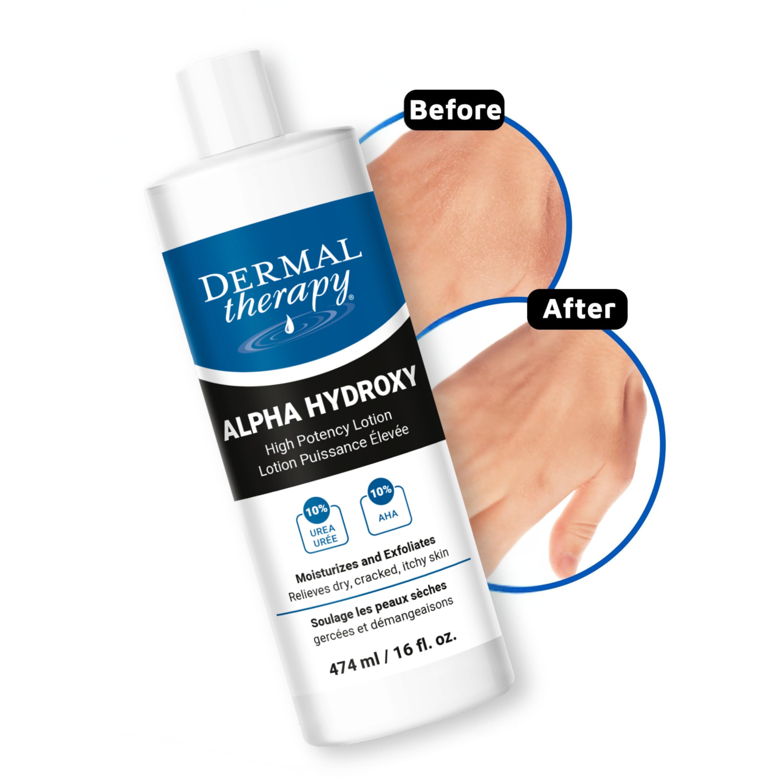 Dermal Therapy Alpha Hydroxy Lotion made in Canada under trusted skincare standards.