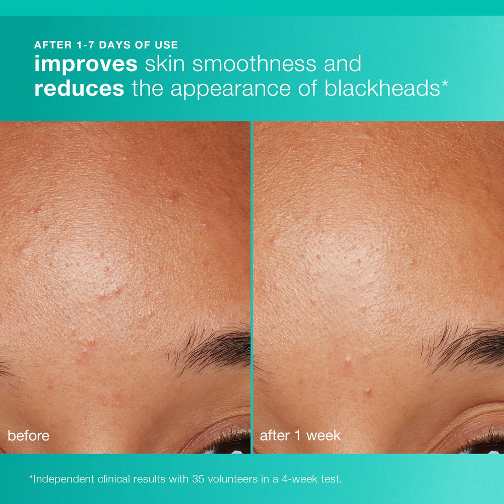 Dermalogica Clear and Brighten Kit cleanser being massaged onto skin for fresh cleansing.