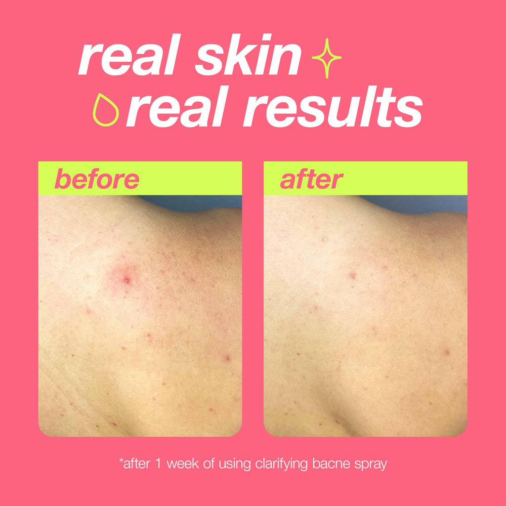 Dermalogica Clear Start argan oil hydration image highlights lightweight moisture for comfortable skin.