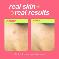 Dermalogica Clear Start argan oil hydration image highlights lightweight moisture for comfortable skin.