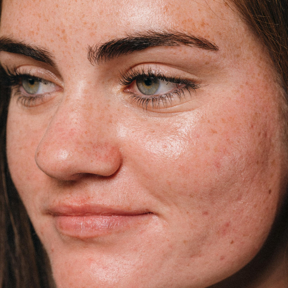 Dermalogica Clear Start Micro-Pore Mist suggests radiant skin after spritz.