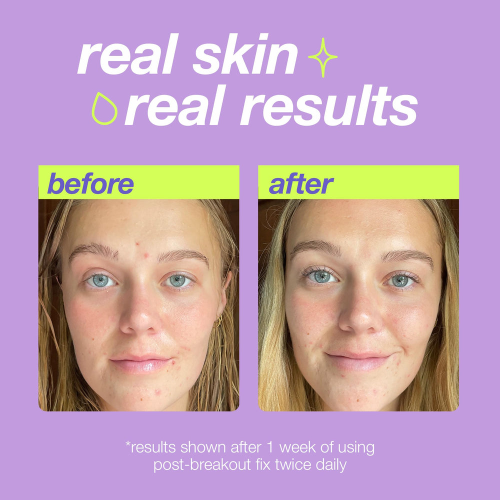 Dermalogica Clear Start swirl on skin hints at even tone after breakouts