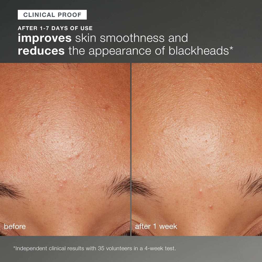 Dermalogica Daily Microfoliant wet-hands paste demonstrates creamy exfoliation.