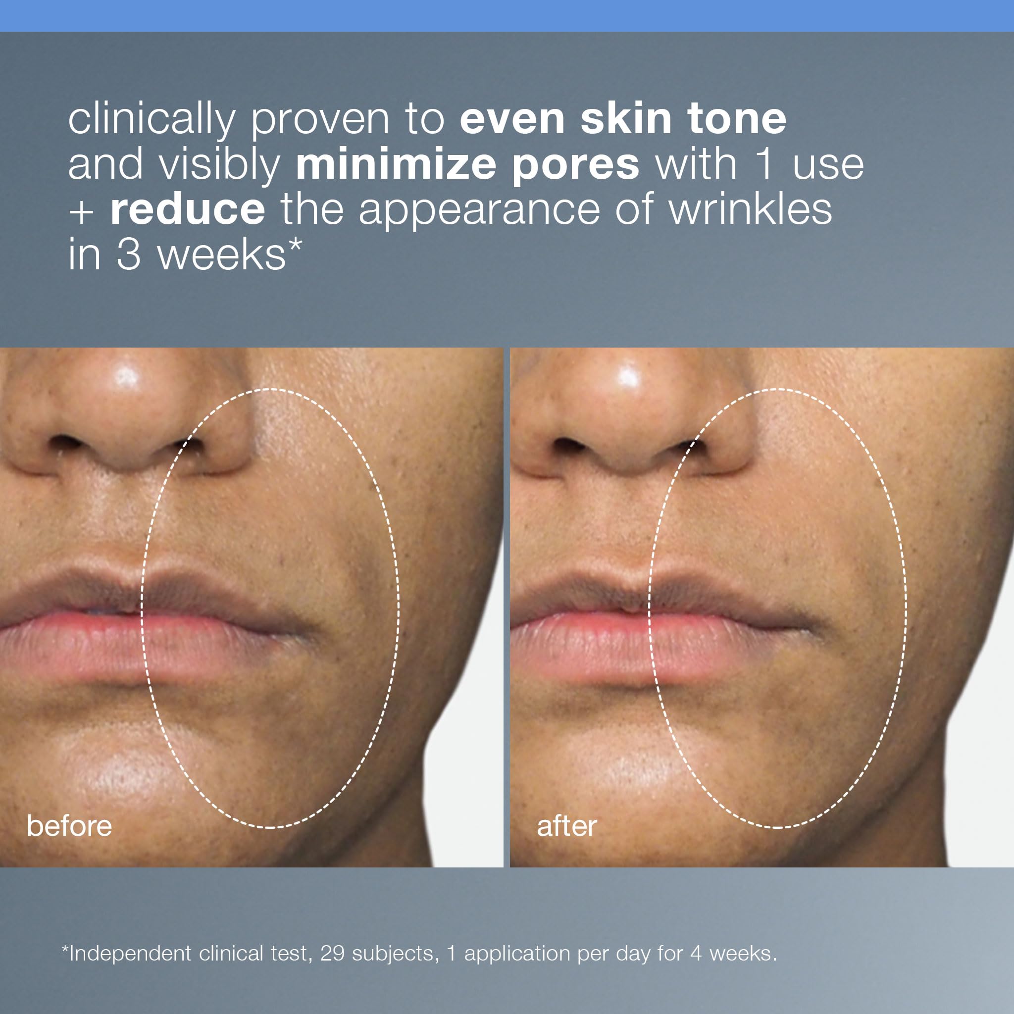 Dermalogica Liquid Peelfoliant ingredients graphic emphasizes acid blend.