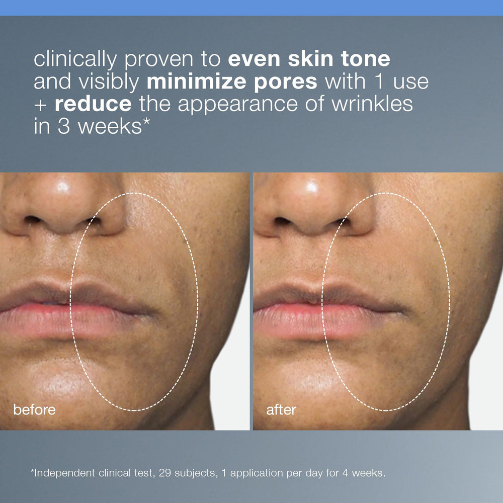 Dermalogica Liquid Peelfoliant ingredients graphic emphasizes acid blend.
