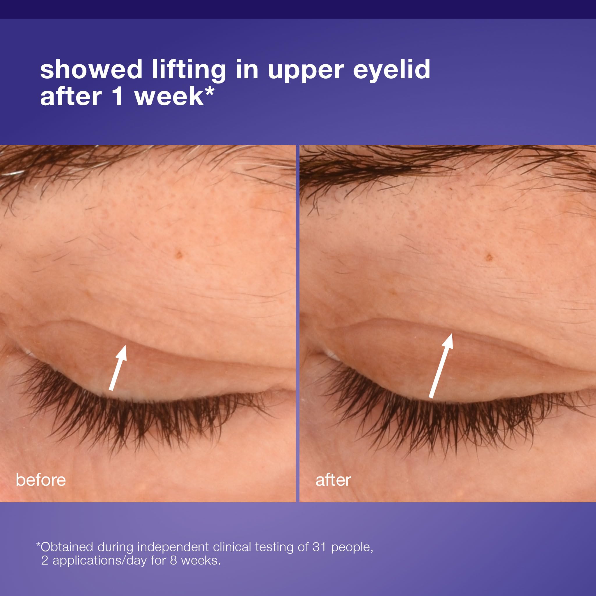 Dermalogica Phyto Nature Lifting Eye Cream packaging display premium eye care.