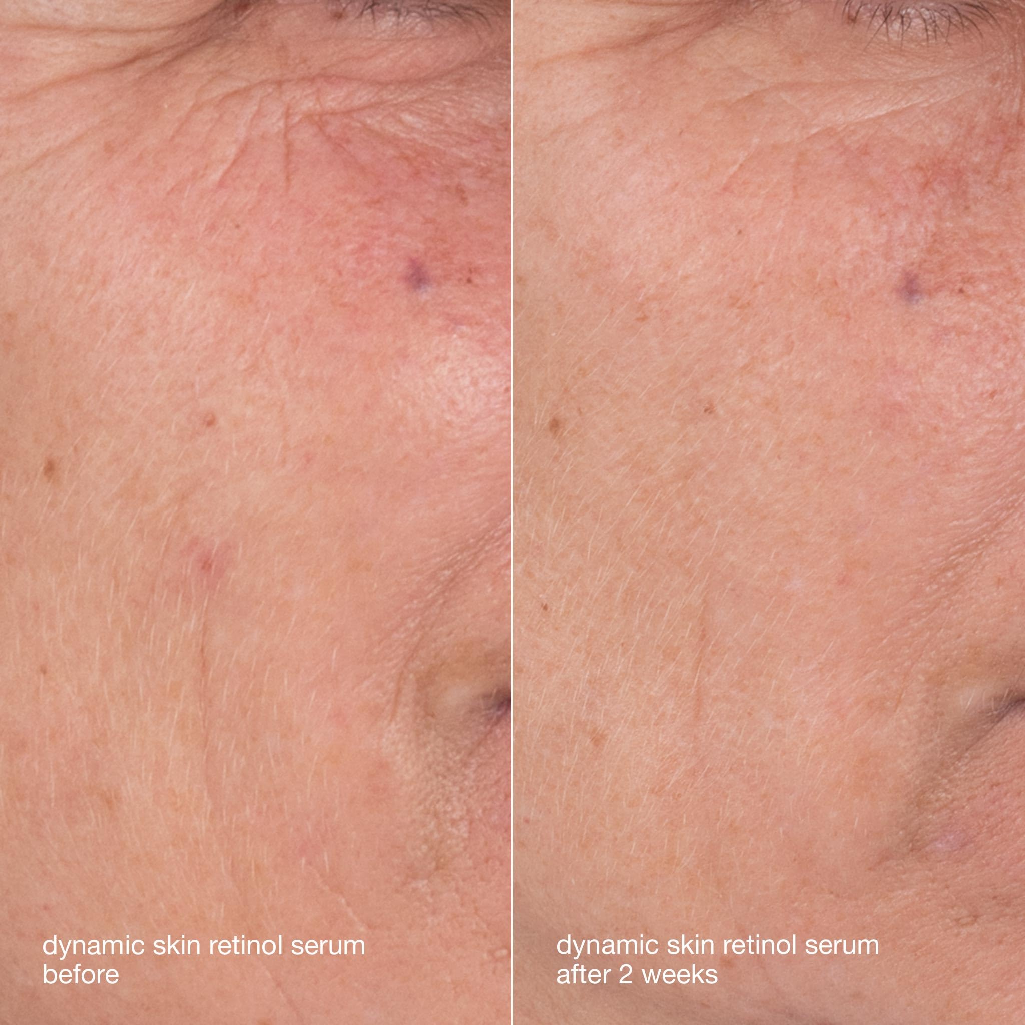Dermalogica Skin Aging Solutions Kit routine display with four essential steps