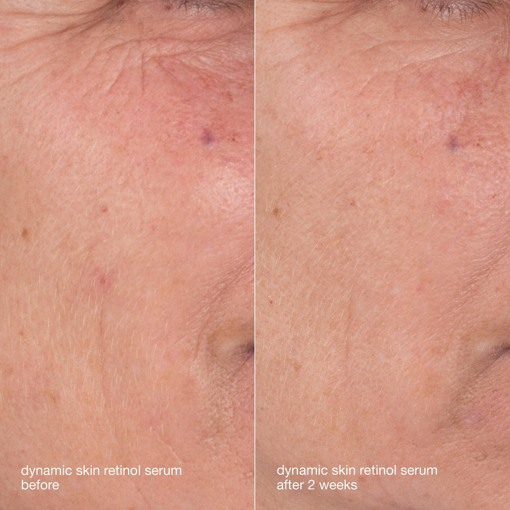 Dermalogica Skin Aging Solutions Kit routine display with four essential steps