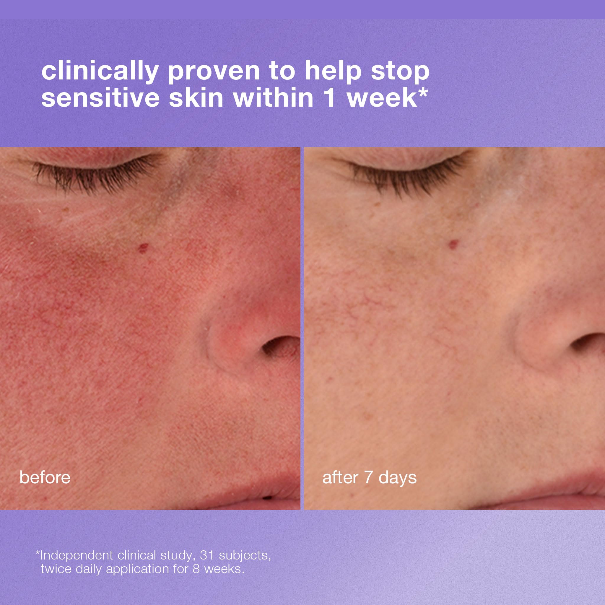 Dermalogica Stabilizing Repair Cream jar close-up emphasizes barrier-supporting ceramides.