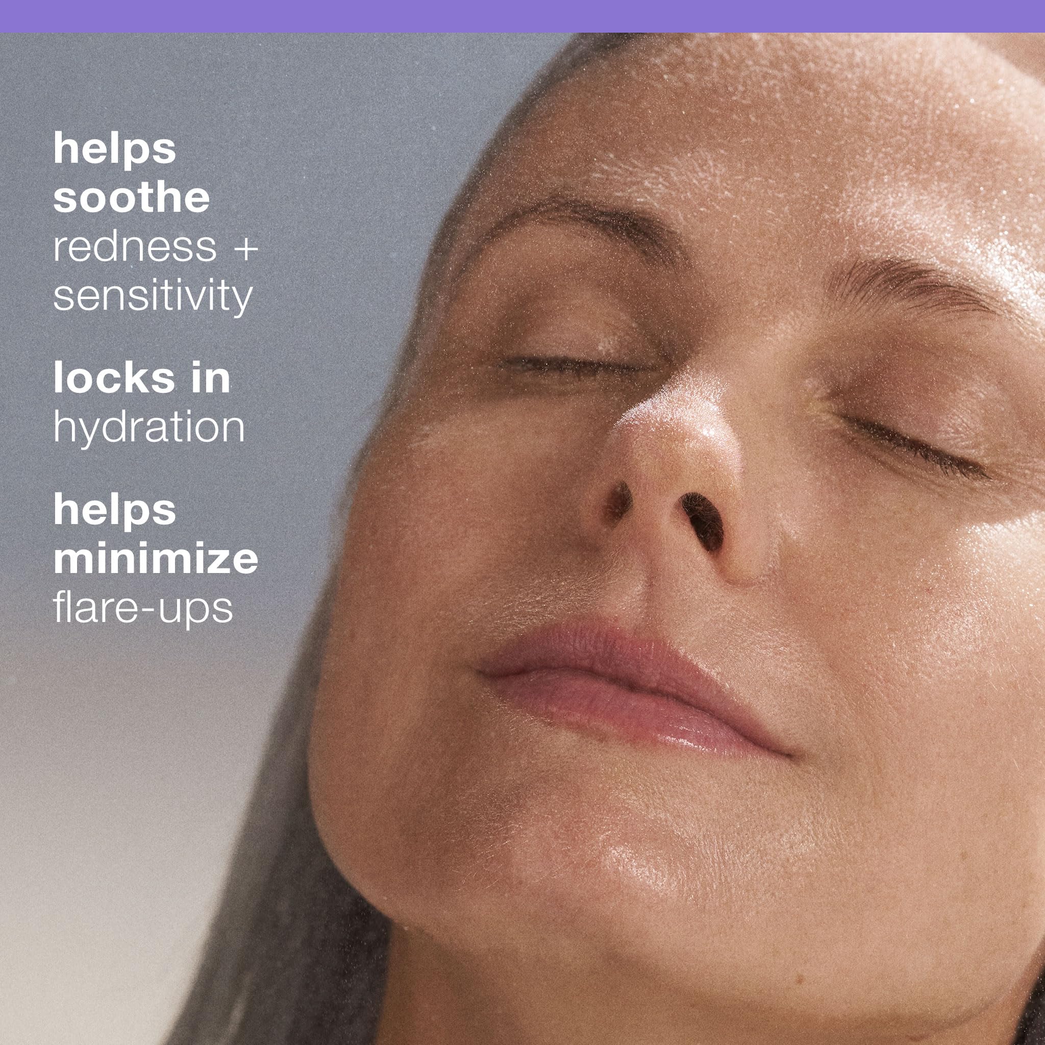 Dermalogica Ultracalming Mist application showing quick relief from irritation
