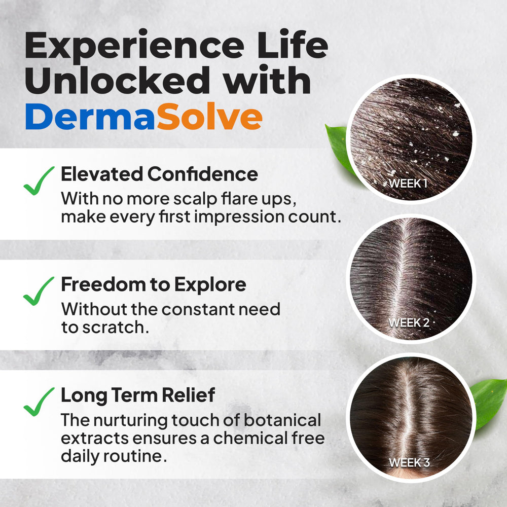 Dermasolve Chamomilla Extract shown for soothing scalp comfort.
