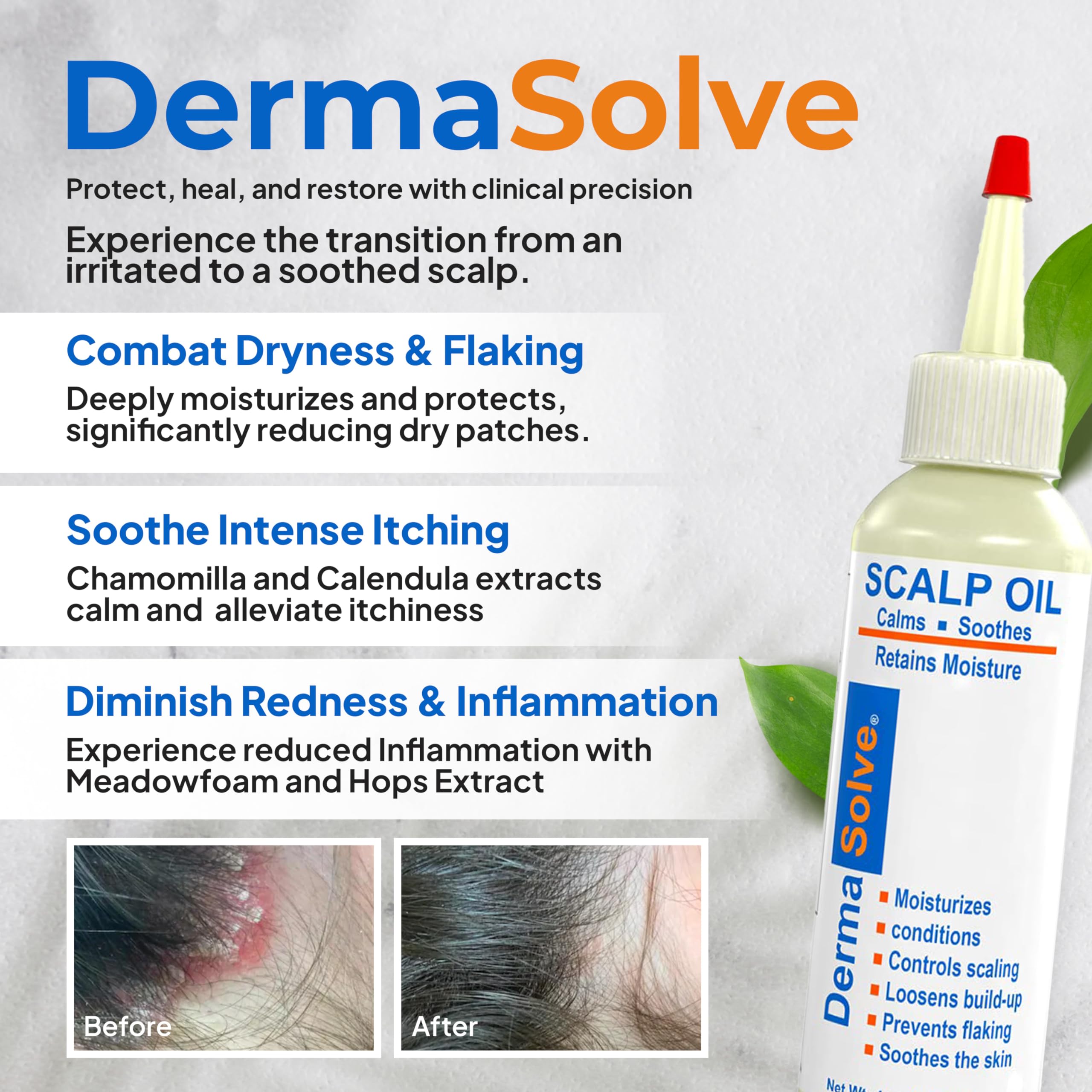 Dermasolve scalp oil dropper in hand for easy targeted application.