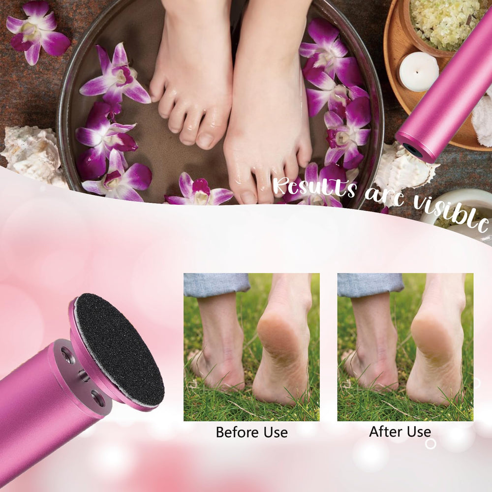 Dermave sandpaper discs ensure quick, hygienic replacements for continuous foot care