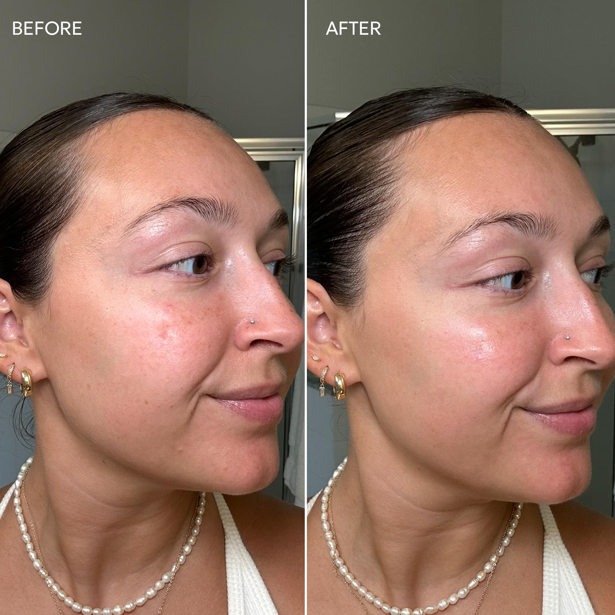 Dermisa packaging emphasizes clean, paraben-free formula for all skin types.