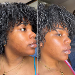 Dermisa Vitamin C and licorice close-up highlights brightening ingredients.