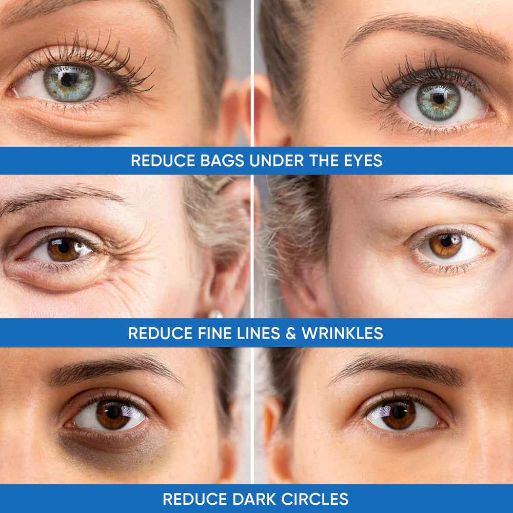 Dermlogic Instant Lift-Sculpt targets crow's feet for a tighter look.