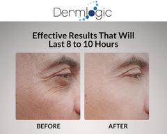 Dermlogic Stem-Cell antioxidants and peptides support long-term eye-area resilience.