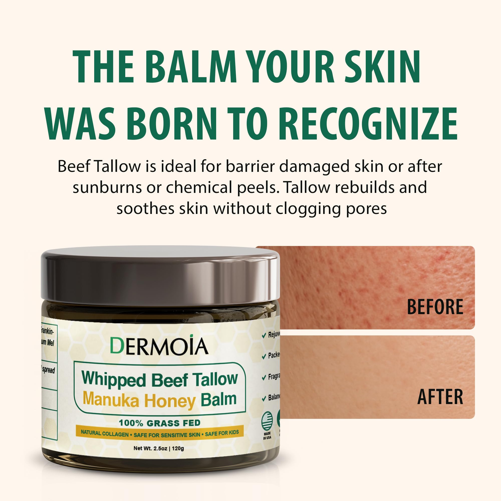 DERMOIA Manuka Honey balm jar close-up highlighting natural ingredients for sensitive skin.