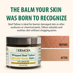 DERMOIA Manuka Honey balm jar close-up highlighting natural ingredients for sensitive skin.