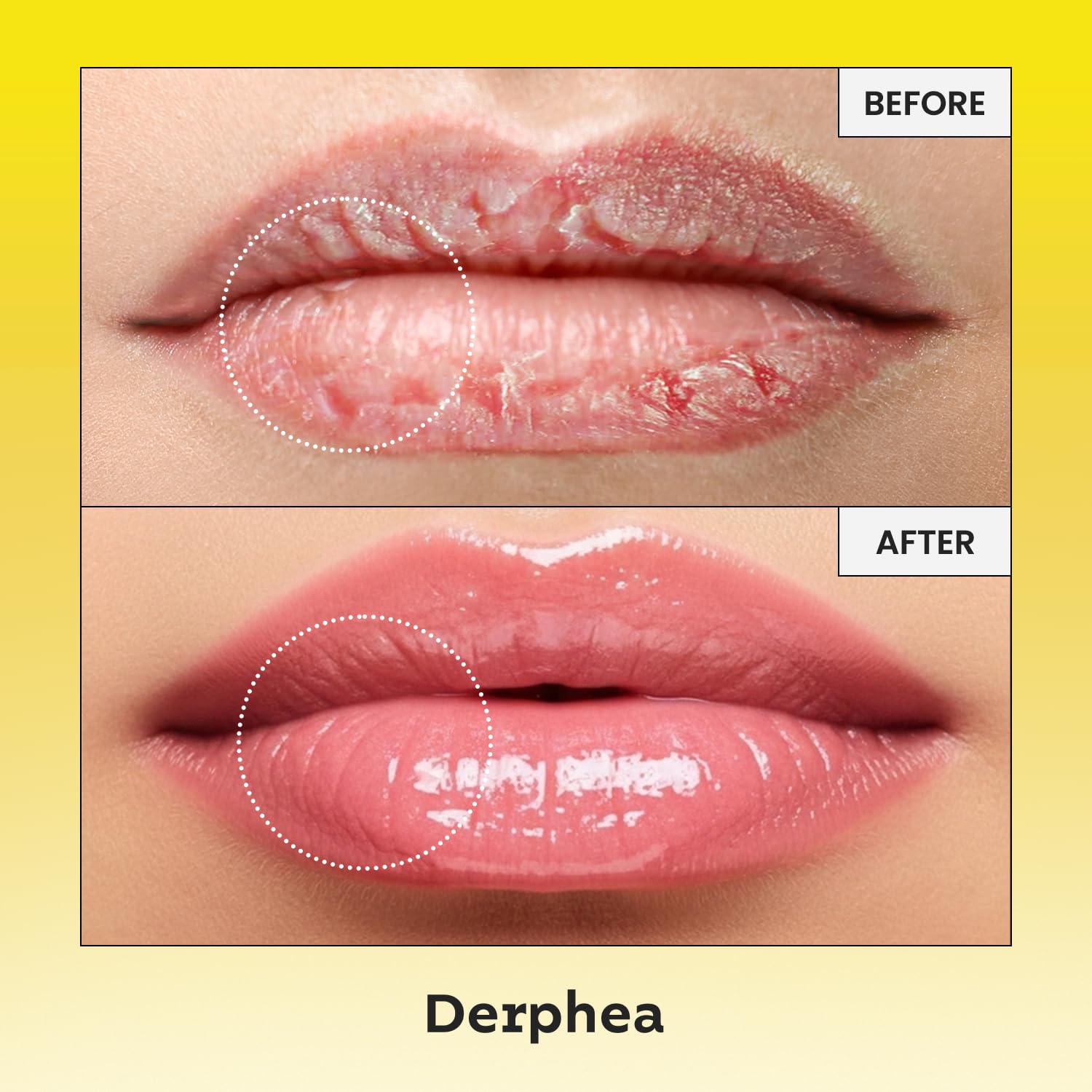 DERPHEA lip balm texture close-up shows light, non-sticky feel for comfort.