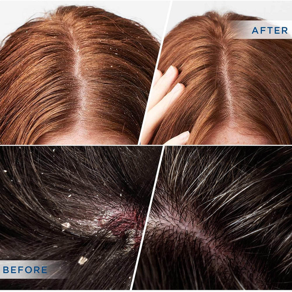 DERPHEA shampoo bottle pour shows even distribution for deep cleansing.