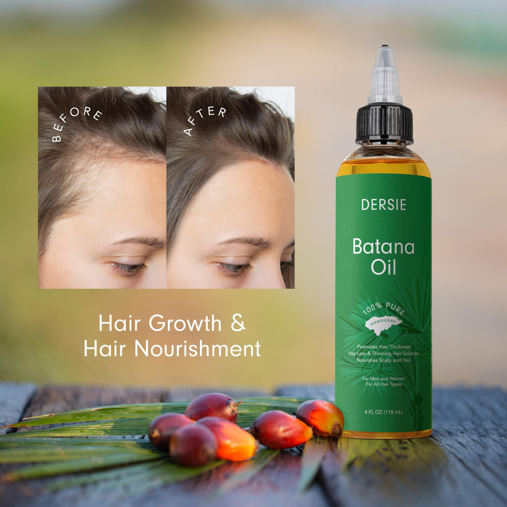 Dersie Batana Oil pack-two bottles emphasizes value and long-term hair nourishment.