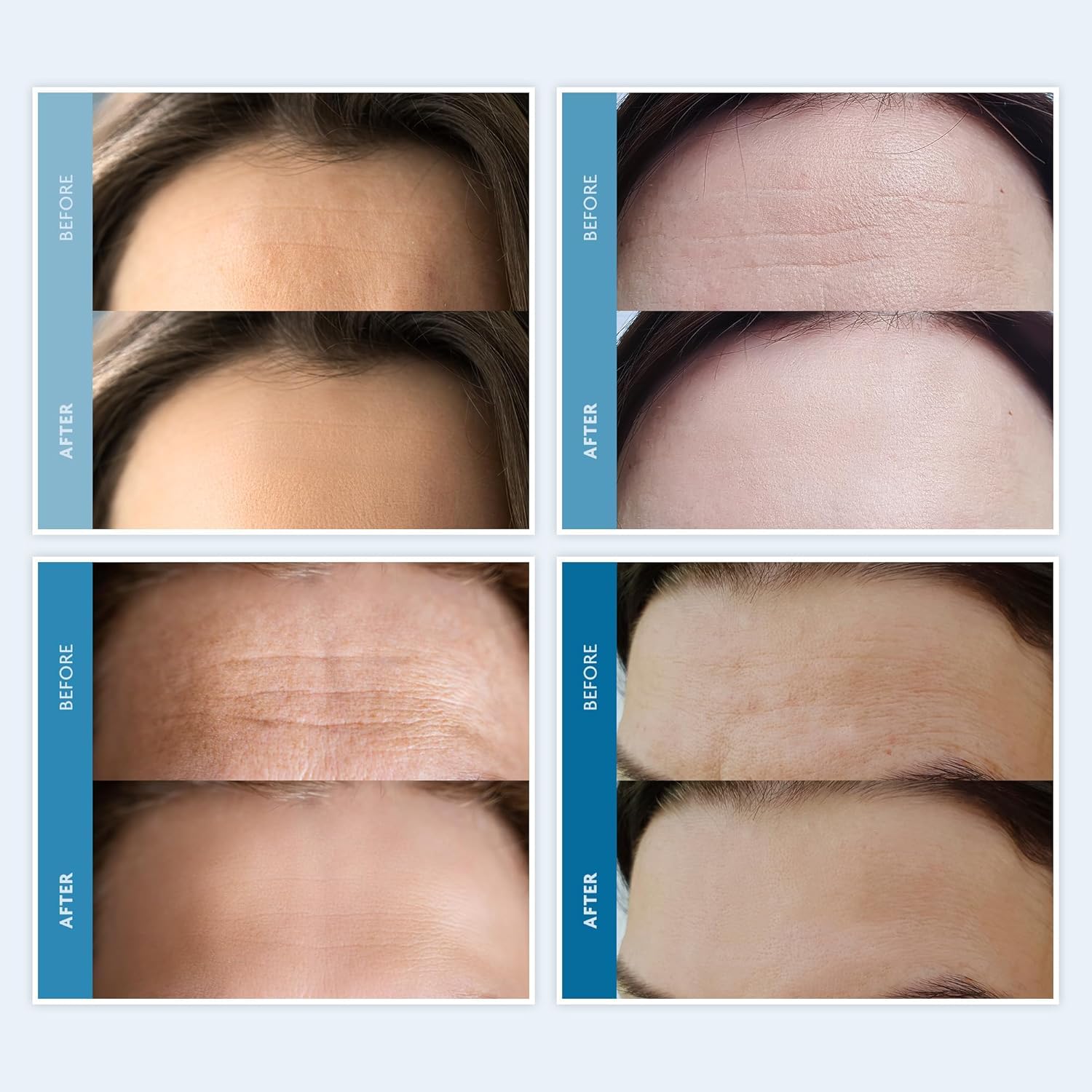 Dersie three-pack silicone patches supports sustainable nightly routine.
