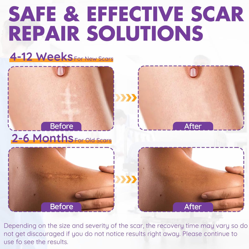 DFK silicone scar sheets provide a hydrated environment for existing scars.