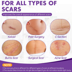 DFK reusable silicone-strips flexibly conform to shapes for improved healing comfort.