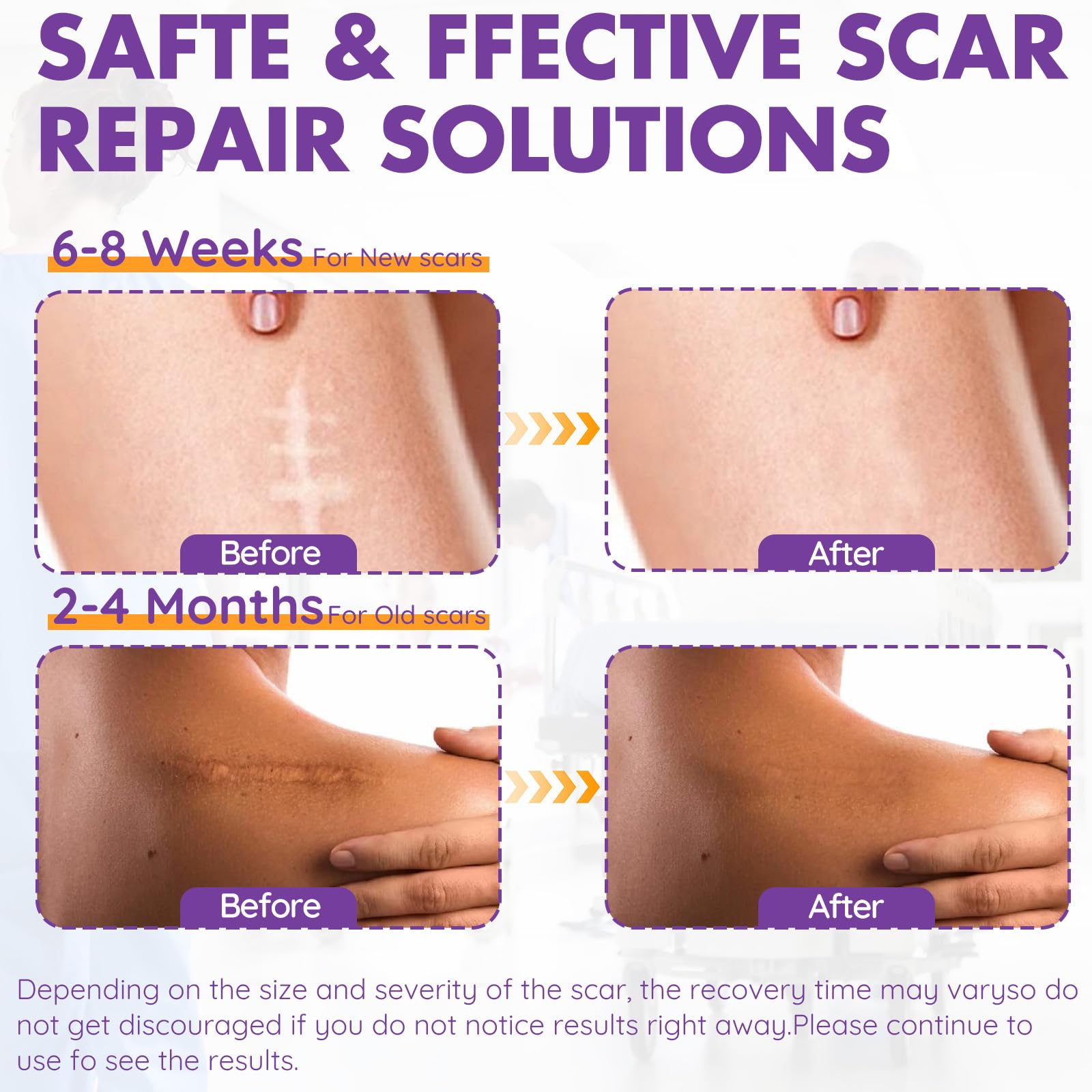 DFK silicone scar sheets closeup highlights soft silicone layer protecting healing skin.