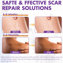 DFK silicone scar sheets closeup highlights soft silicone layer protecting healing skin.
