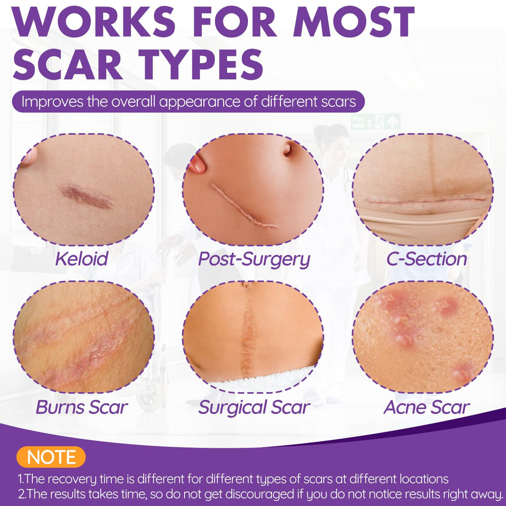 DFK silicone scar tape on skin demonstrates conforming fit and gentle protection.