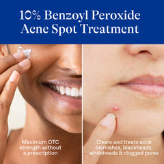 Differin application on finger demonstrating precise spot coverage to treat a blemish