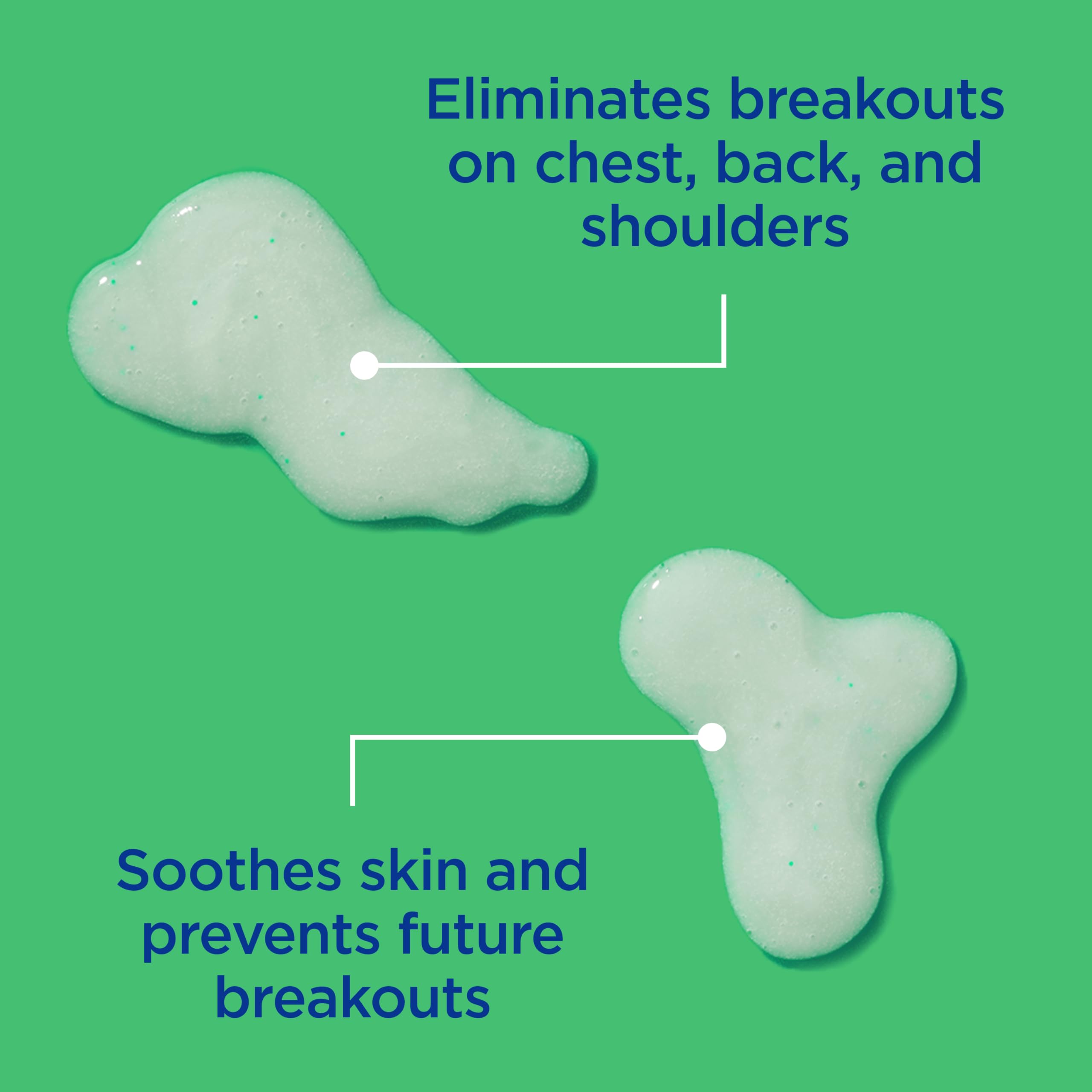 Differin ingredient callout highlighting salicylic and glycolic acids for pore clearing