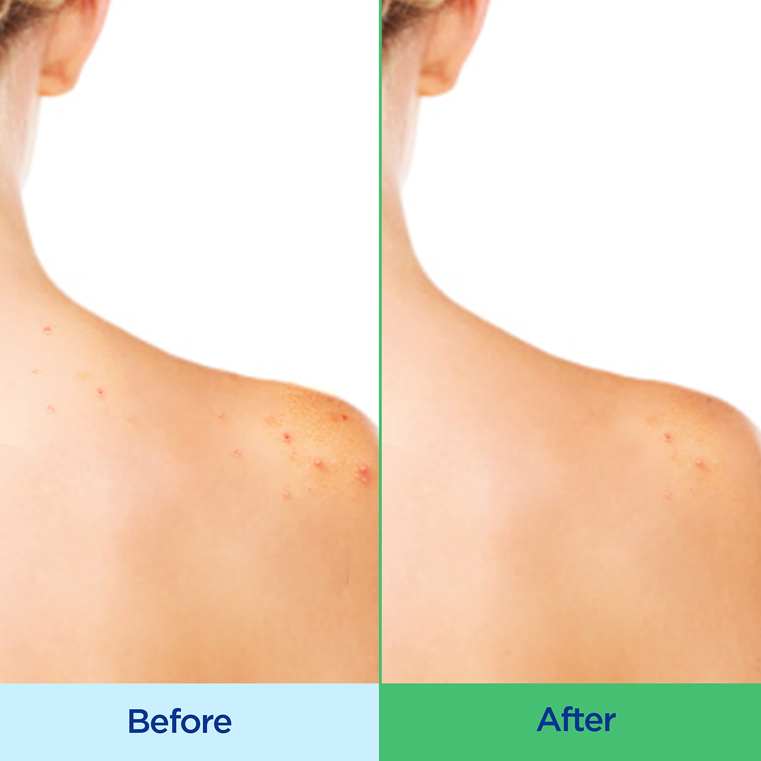Differin body wash lather in hand demonstrating effective coverage