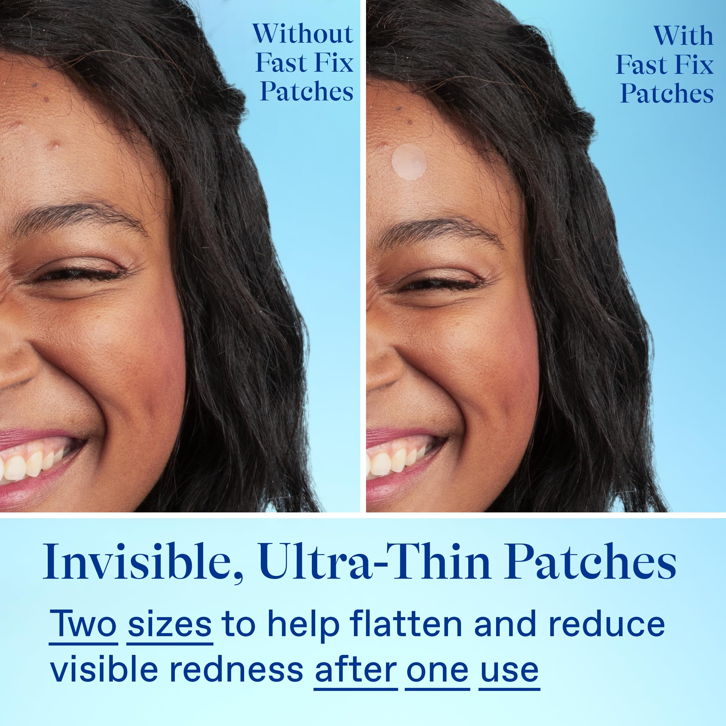 Differin label showing salicylic acid and centella asiatica ingredients