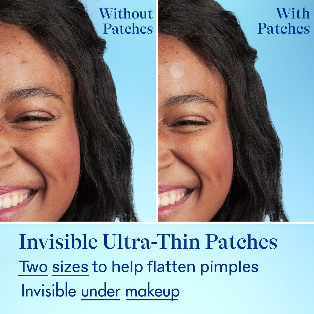 Person using Differin in mirror showing confident skincare use and results