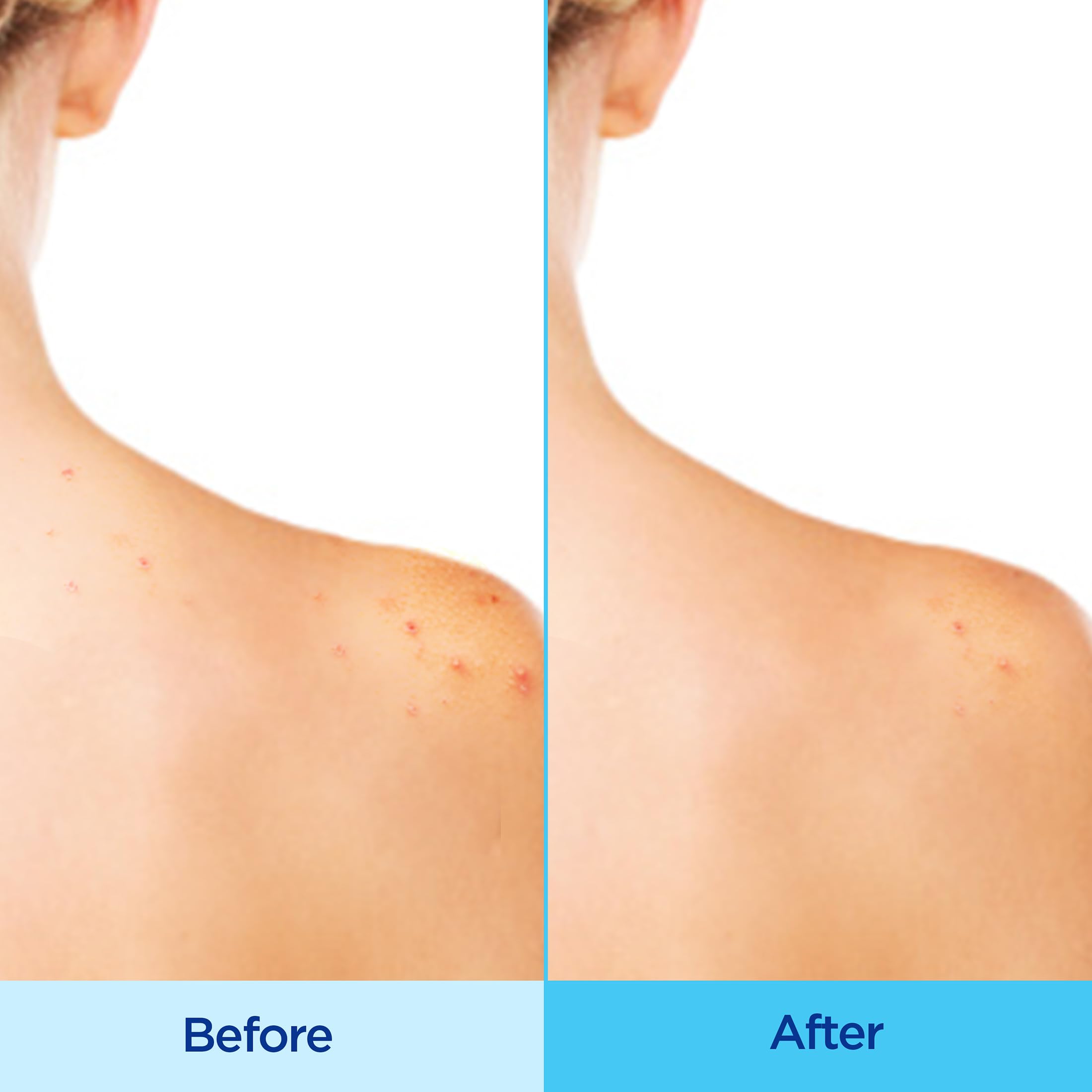 Differin fine mist texture close-up demonstrating even coverage and quick drying